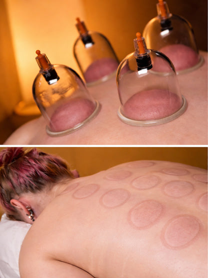 Bańki chińskie bezogniowe próżniowe do masażu - Zestaw 12 sztuk z pompką w etui